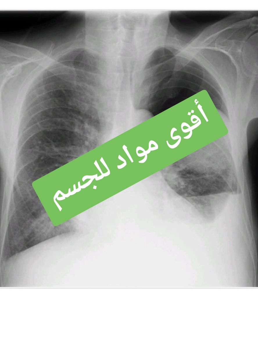 مواد للقوة #dr_atou #foryoupageofficiall #طب #قولون_عصبي #viraltiktok #foryou #viralvideos #viral 