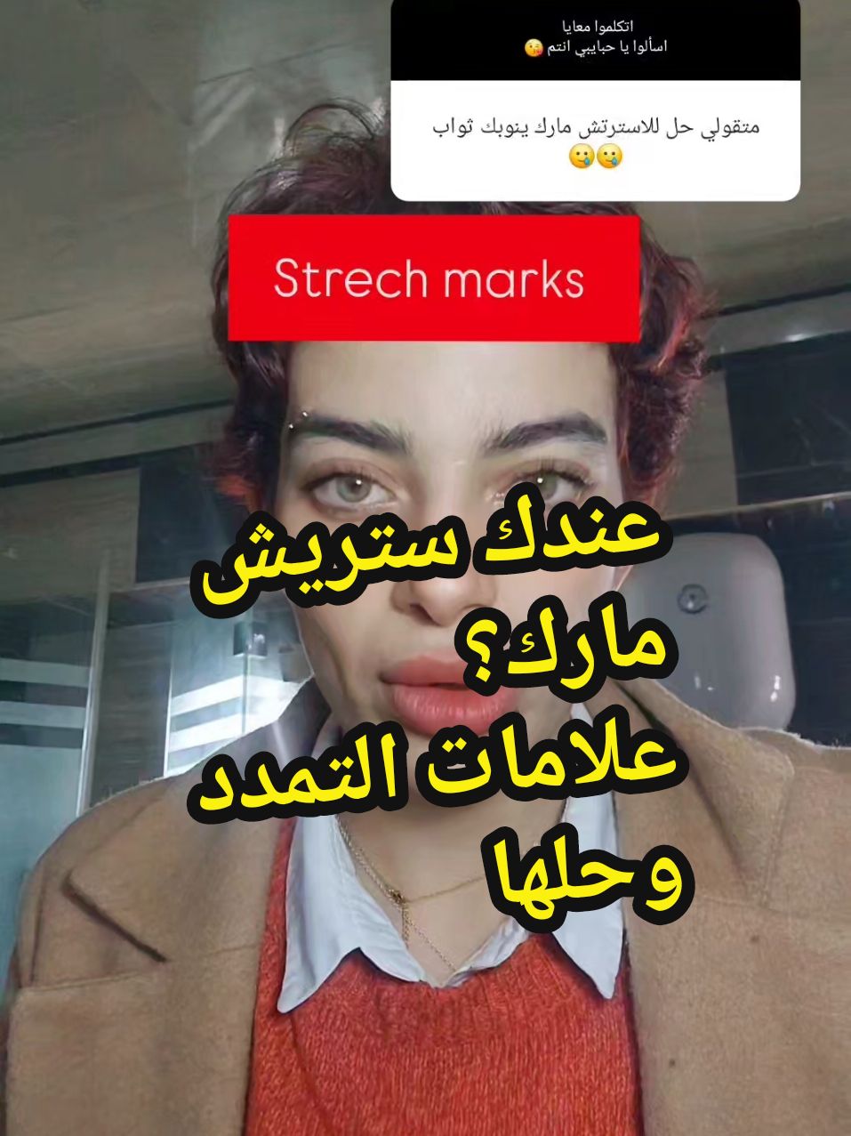 حل علامات التمدد  حل سترتش ماركس  strech marks 