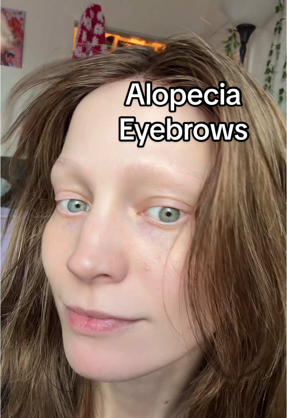 dont ever fall for products that claim to help your hair grow back for alopecia, but taking care of your general health can make a difference. No guarantees but it’s also great for your general wellbeing even if you dont notice a difference with your hair.💜 #alopecia #hairloss #health #autoimmunedisease 