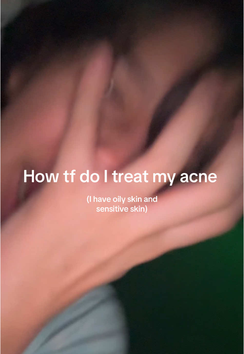 HOW DO I TREAT MY ACNE HELP ME PLS PLS PLS #ACNE #acne #fyp #help #dermatologist #skin #oilyskin 