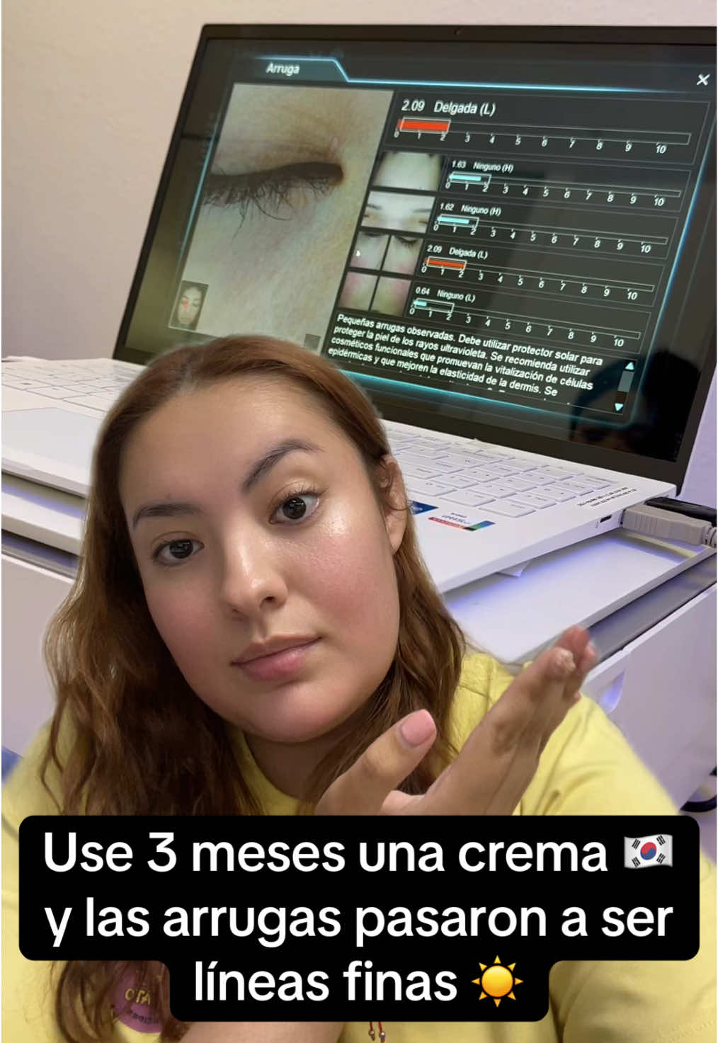 #greenscreenvideo #niacinamide #collagen #hyaluronicacid #centellaasiatica #niacinamida #piel #pieldeseda #acidohialuronico #cica #allskintypes✊🏻✊🏼✊🏽✊🏾✊🏿 #amorpropio #arrugas  #lineasfinas #estrias #bonita #hiperpigmentacion #pielseca #pielsana #manchas #nutricion #Lifestyle #skin #skin #manchas #belleza #amorpropio  Chicas como pueden ver y comparar con mis tiktok anteriores pues les muestro la realidad y mi proceso con la crema de nida :) si se animan ahi me dicen 💓🫵 