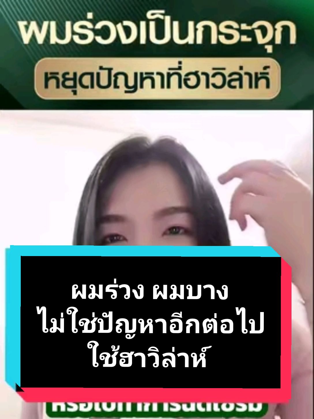 ปัญหาผมร่วง ผมบาง แก้ไขได้ด้วยฮาวิล่าห์แชมพูและแฮร์โทนิค ด้วยสถิติการรักษาได้ผลเป็นอันดับ 1 สิบปีซ้อน ผลิตภัณฑ์แนะนำ (ชุดที่เห็นผลมากที่สุด) 1. ฮาวิล่าห์แชมพู ขนาด 300 ml. ราคา 890 บ. (จากราคาปกติ 1,190 บ.) 2. ฮาวิล่าห์แฮร์โทนิค ขนาด 100 ml. ราคา 690 บ. (จากราคาปกติ 990 บ.) ผมร่วงน้อยลงชัดเจนตั้งแต่ชุดแรกที่ใช้ และผมเริ่มขึ้นใหม่ในเวลา 3-4 เดือน #แชมพูลดผมร่วง #เซรั่มปลูกผม #ลดผมร่วง #ฮาวิล่าห์  #havilah 