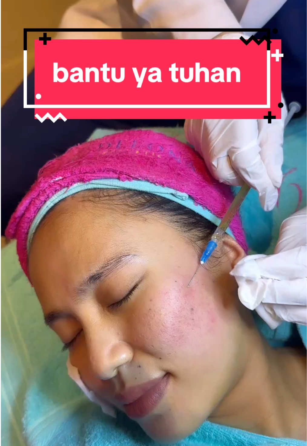 diawali dengan memperbaiki penampilan🥰 #fyp #infuswhitening #suntikputih #klinikkecantikanbekasi #delonabekasi #mancunginhidung #klinikkecantikan #delonaaesthetic #tarikbenang #delona #facial #delonasc #ramadhan #benanghidung #botox #aestheticclinic #resolusi2025 #fillerbibir #sexylips #promoakhirtahun #newyearnewlook 