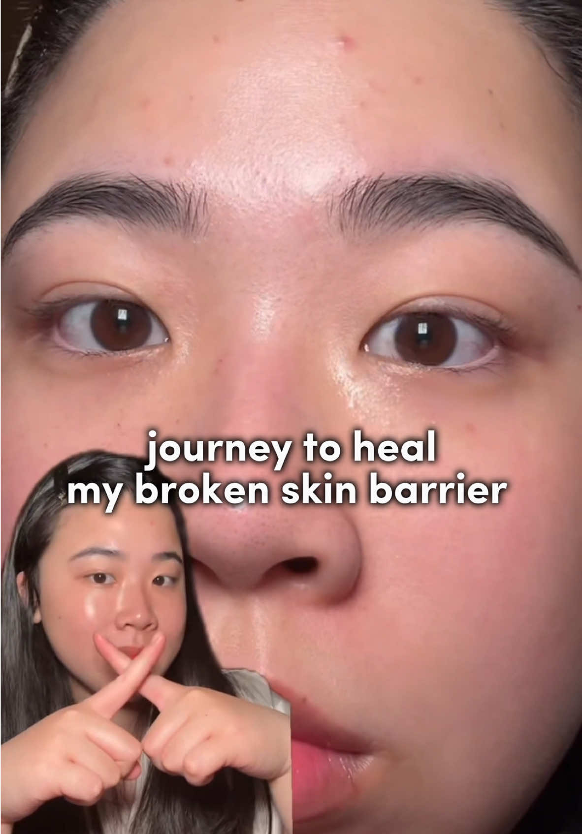 Ruin your skin barrier? this is my journey to heal my broken skin barrier 🥰✨ @Abib Global  - #abib #abibholidaymoonglowbox #abib_global #TECA #holidaybox  #holiday #holiday2024 #beautybox #unboxing #kbeauty #koreanskincare #skincarejourney #skincareroutine #fyp