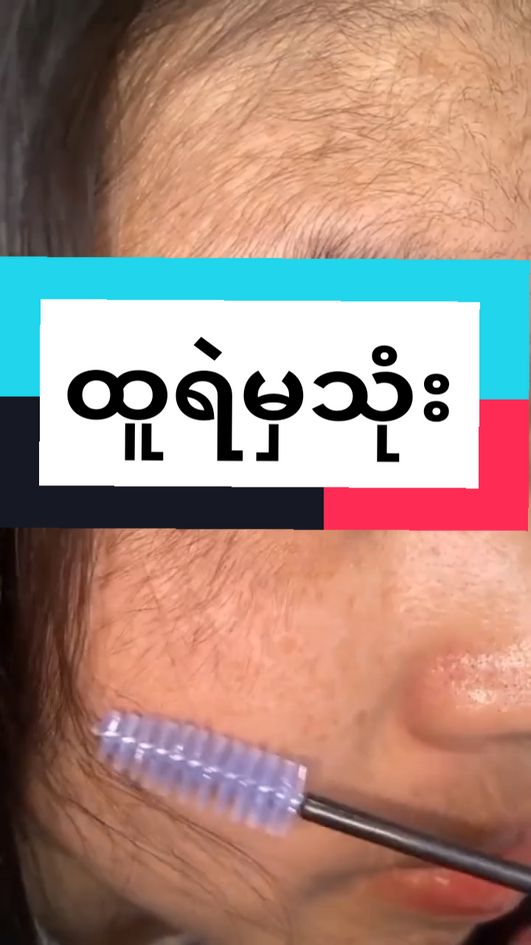 Replying to @user3525814580754 #ထူတာကြိုက်မှသုံး #အမွှေးပါးတဲ့သူဆီရောက်စမ်း #အမွှေးထူတဲ့သူတွေလုံးဝဝယ်မသုံးပါနဲ့ #အမွှေးထူတာကြိုက်မှသုံး #အမွှေးပါးပါးကြိုက်ရင်ရှောင် #အမွှေးပါးလို့စိတ်ညစ်မနေနဲ့ #ဆေးစက်ချရာအမွှေးပေါက် #ဆေးရည်ကျရာအမွေးပေါက်တာမို့ #ဆေးရည်ကအဝါရောင်လေးပါ #doublehotbiohairserum #အာမခံအမွှေးပေါက်ဆေး #မျက်ခုံးမွှေးပေါက်ဆေး #ဆံပင်ပေါက်ဆေး #ပါးသိုင်းမွှေးပေါက်ဆေး #နှုတ်ခမ်းမွှေးပေါက်ဆေး #အမွှေးပေါက်ဆေး #အမွှေးသန်ဆေး #အမွှေးထူဆေး #fyp#fypシ゚ #fypage #fypp #fyppppppppppppppppppppppp #edit#cupcut#tiktok#tiktokuni#tiktoknews#tiktokmyanmar#tiktokviral#tiktoktrend#trending#trendingvideo#trendingsong#stagevoice#foryou#foryoupage #thankb4youdo #ရောက်ချင်တဲ့နေရာရောက်👌 #ရောက်စမ်းfypပေါ် #မဖလုတ်နဲ့ကွာ☹ #မဖလု#မဖလုတ်ပါနဲ့ttရယ် #views#viewsproblem💔 #viewsတွေရှယ်ကျ🙂👍 #မြင်ပါများပီးချစ်ကျွမ်းဝင်အောင်လို့🤒🖤 #တွေးပြီးမှတင်ပါ 