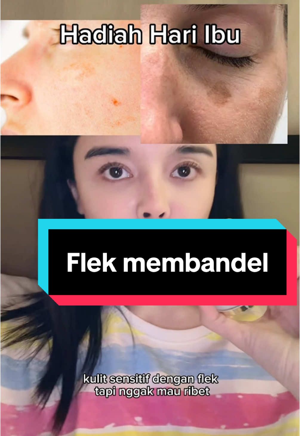 Flek yang melebar dan membandel boleh coba cysteamine HnH soalnya sudah ada tranexamic, gluthatione, glycolic acid yang dari penelitian itu setera dengan efek hydroquinone 4% tapi ini ga bikin okronosis kalo jangka panjang. Hadiah perfect banget buat mama kalian yang udah mulai muncul solar lentigo. Buat kita2 jg bagus tp lebih cocok untuk dry skin kalo untuk pelembabnya. Kalo oily pake serumnya aja totol2 di fleknya ya. Kalau kasih skincare ke mama tuh jangan yg ribet2 nanti malah mereka bingung dan ga dipakai. Pagi sunscreen ya. Maap spamming review soalnya besok 12/12. Aku jg masih utang autumn dan bbrp brand lain nih. Tp gausah pusing bgt biasa promo itu bbrp hari setelah 12/12 kok. Btw boleh OOT ya gengs aku senang bales2 komen nambah ilmu di aku jg #whitening #cysteamine #flek #lentigo #mothersday #cream #melasma #skincare #HnH #kamilajaidi #prescription #praktis #mama #mother #brightening #cerah 