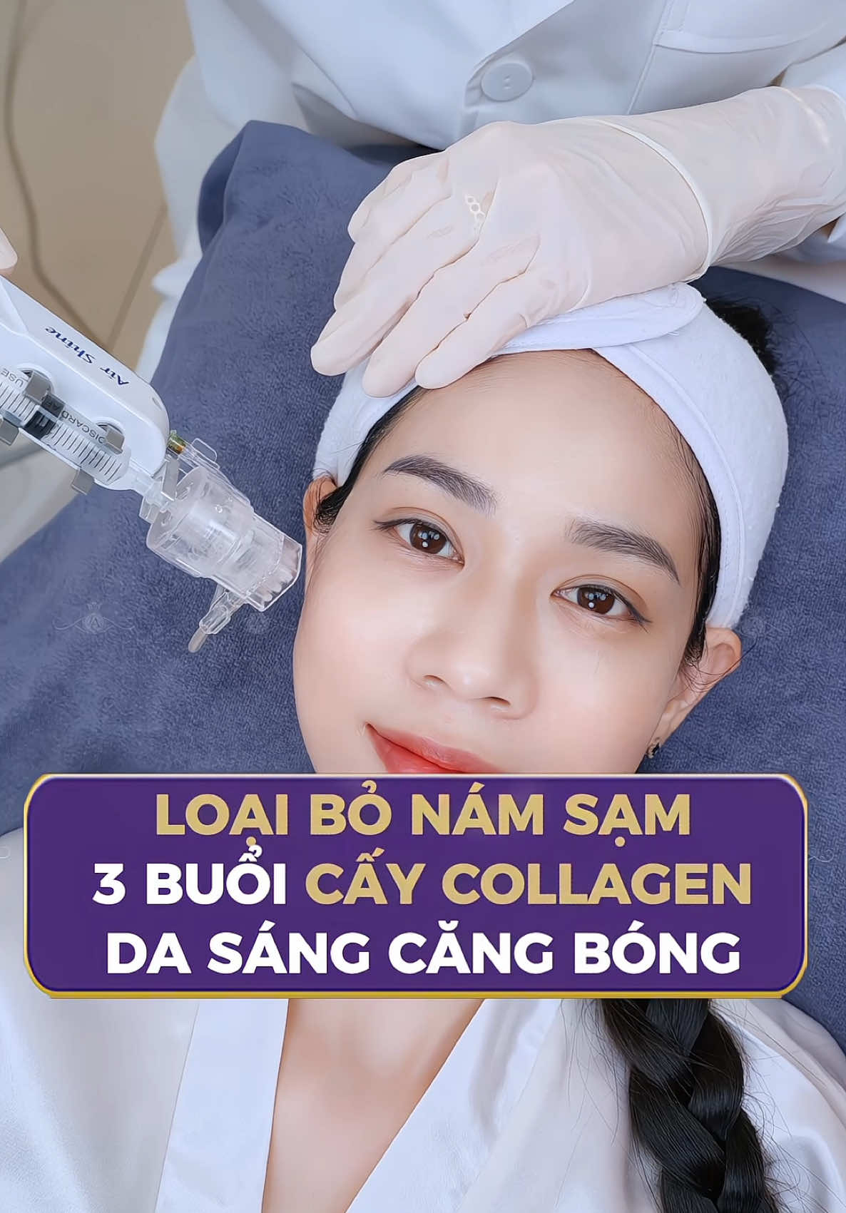 Chị Phước LOẠI BỎ nám sạm chỉ sau 3 buổi CẤY COLLAGEN! Lấy lại ngay làn da sáng mịn, căng bóng với ƯU ĐÃI ĐẾN 65% - ĐĂNG KÝ NGAY TẠI ĐÂY #thammylinhanh #lamdep #caycollagen #trehoada #dacangbong #namda #tannhang 