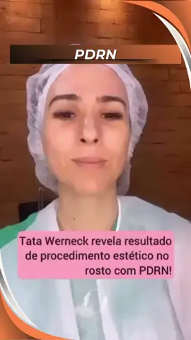 Dica da Tata! 🤣🤣🤣 O PDRN (ou polinucleotídeo desoxirribonucleico) é um ativo incrível extraído do DNA de peixes, como o salmão( mais especificamente do esperma, por isso a brincadeira dela, rs), e tem um poder regenerativo único! Ele estimula os componentes celulares, melhora a textura da pele, aumenta a produção de colágeno e combate o envelhecimento, deixando sua pele mais jovem, saudável e luminosa. 💎 🌿 Transforme sua pele com ciência e tecnologia avançada! #PDRN #esteticaregenerativa #dicasdebeleza  #tatawerneck 