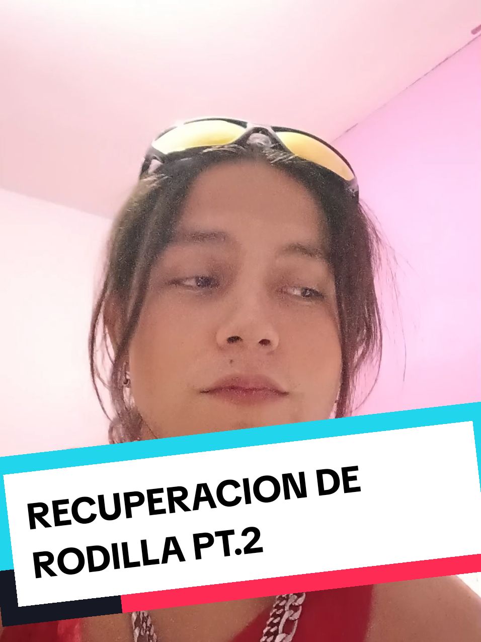 Aquí la segunda parte de mi recuperación!! YA ME QUITARON LOS PUNTOS!!! MUCHAS GRACIAS A TODOS CHICOS POR EL APOYO!!!♥️♥️♥️🥰🥰#recuperacion #herida #mequitaronlospuntos #cirujiaderodilla #cirujia #blog #blogsito #graciasporelapoyo #apoyo #kirito85xd #losamo #losquieromucho 