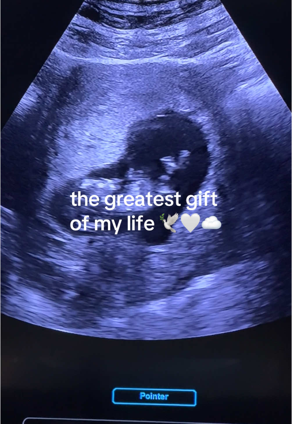The journey to our sweet little baby ☁️🕊️🤍 we cant wait to meet you!!! #ttc #pregnant #pregnancyannouncement 