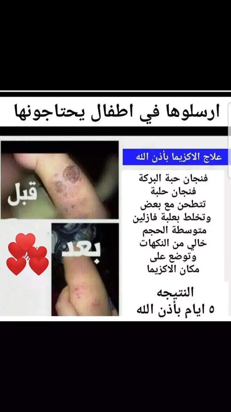 وصفة علاج#رياكشنات_مطلوبه #خواطر #علاج_بالاعشاب #علاج_طبيعي #storytime #standwithkashmir #tiktok_india #video #videoviral #video #quraan #قران 