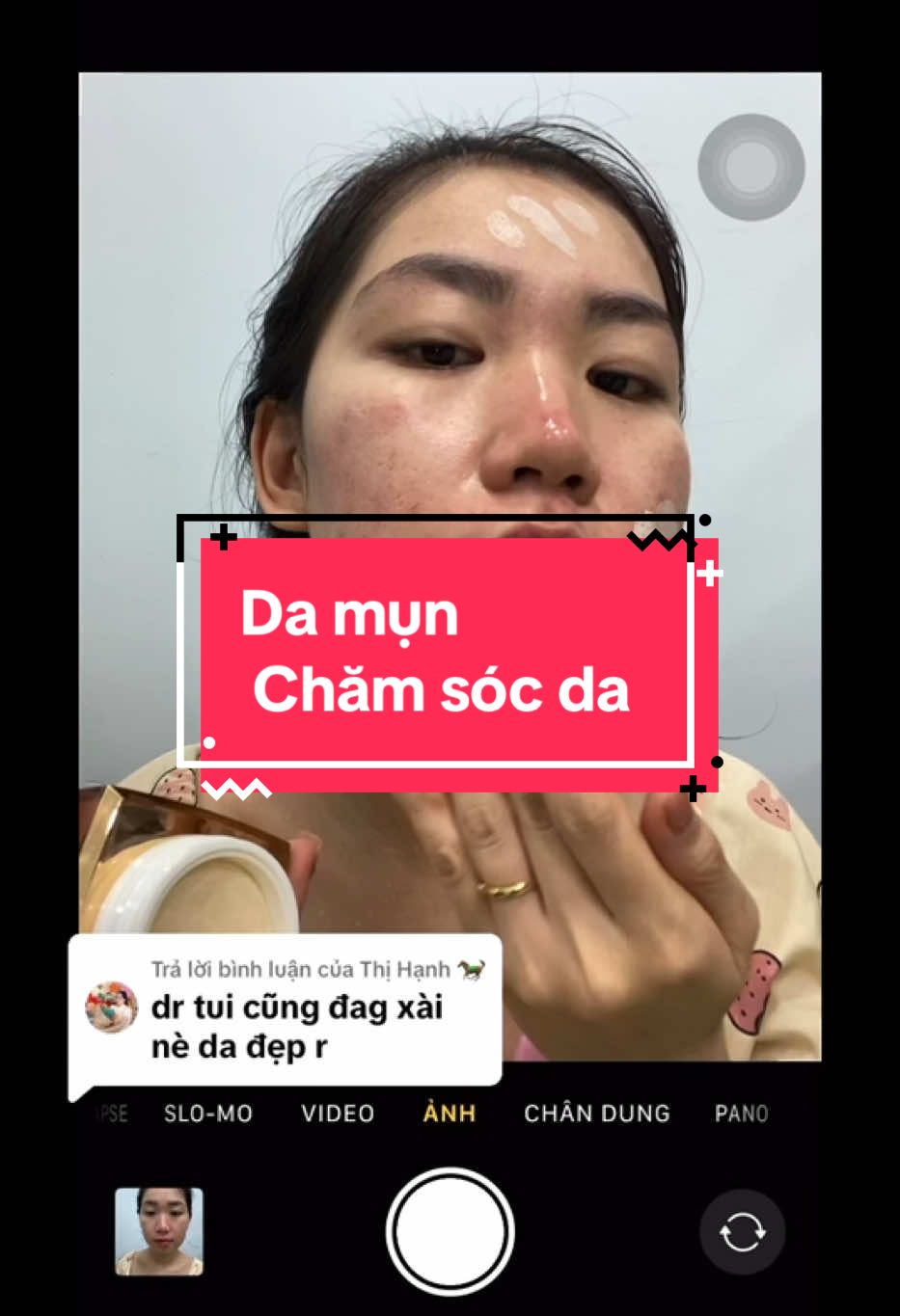 Da Mụn Thâm Xài cái nào#xuhuong #myphamchinhhang #nhuybeautyquan12 #Demejinechinhhang #trịmụn #kemduongtrangda 