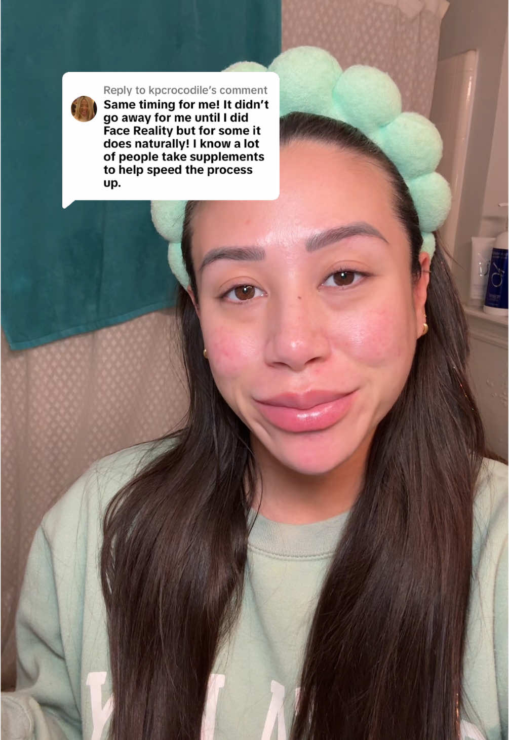 Replying to @kpcrocodile acne is such a beotch 🙃 #postbirthcontrolsyndrome #postbirthcontrolacne #postbirthcontrolproblems #acne #acnetreatment #acneskin #acneproneskin #acneskincare #acnefighter #acnecheck 