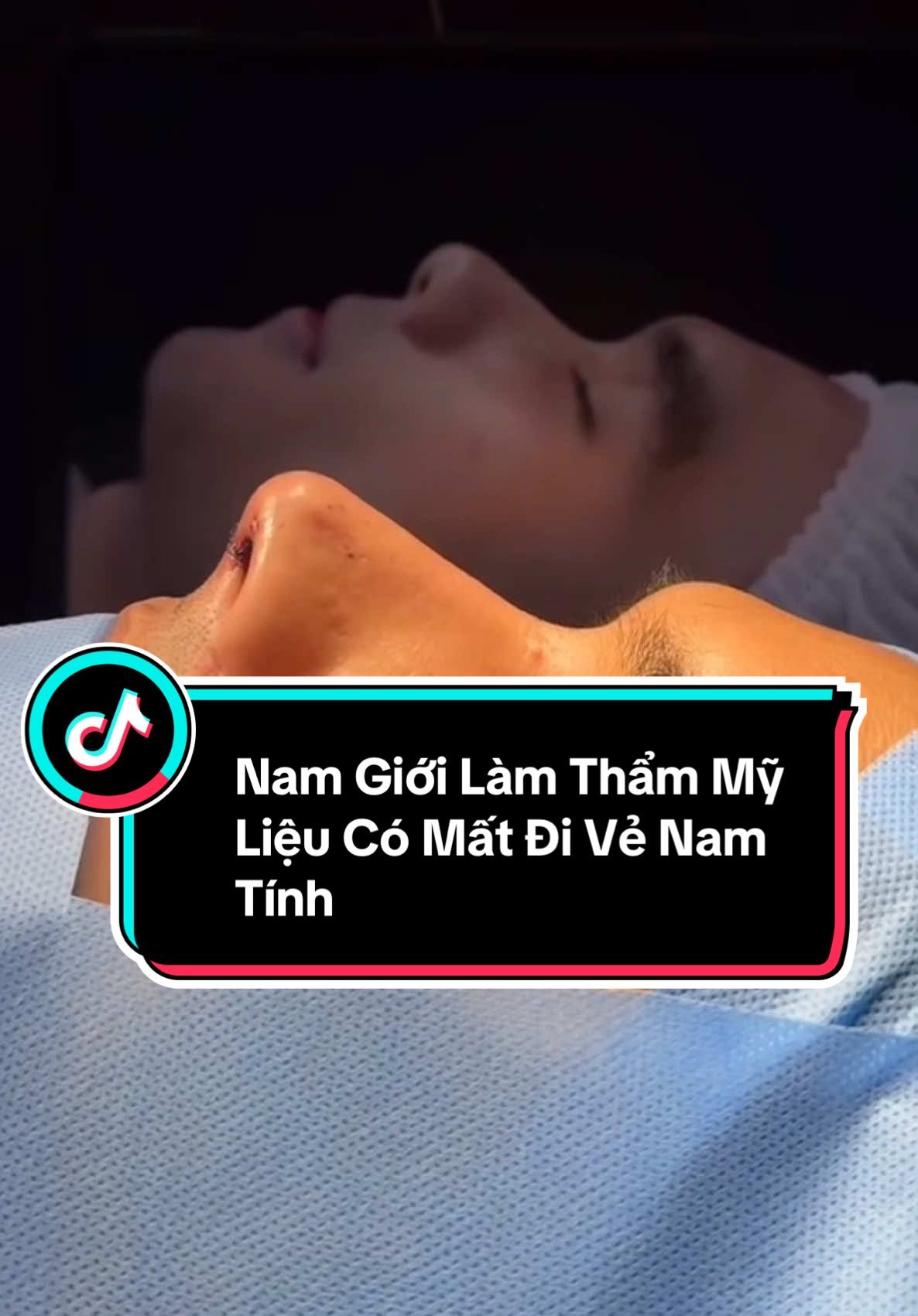 Nam Giới Làm Thẩm Mỹ Liệu Có Mất Đi Vẻ Nam Tính #xuhuong #trending #pttm #nangmui #nangmuicautruc #sline #lline #drlongck1pttm #rhinoplasty 