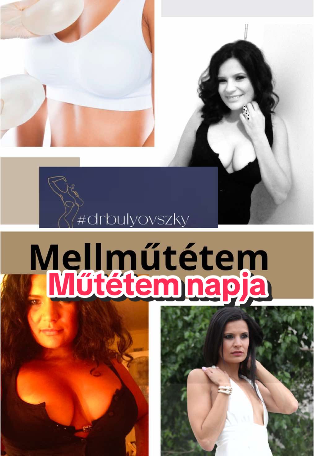 #műtét #mellműtét #plasztika #implantátum #izgulok #szentmargitkórház #bulyovszkyistvan #plasztikaisebész #plasztikaisebészbudapest #drbulyovszky 