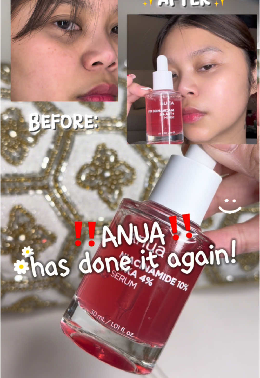 @anua_global has done it again!🍒 Test out this next viral Kbeauty serum with me and see visible results in a week! Get this at Anua’s official Store in tiktok or Amazon! 🛒 @Anua Store US @umma.influencers @anua_influencers  #fyp #ugccreator #ugccommunity #anua #darkspot #ANUA #anuaserum #darkspots #hyperpigmentation #koreanskincare #kbeauty #skincare #brightening #acnescars #glassskin  #vitaminB #postacnemarks #skincaretips #clearskin #Hyaluronicacid #Niacinamide #ampoule #Serum #Clean #Beauty #koreanbeauty #asianbeauty #koreancosmetics #asianbeauty