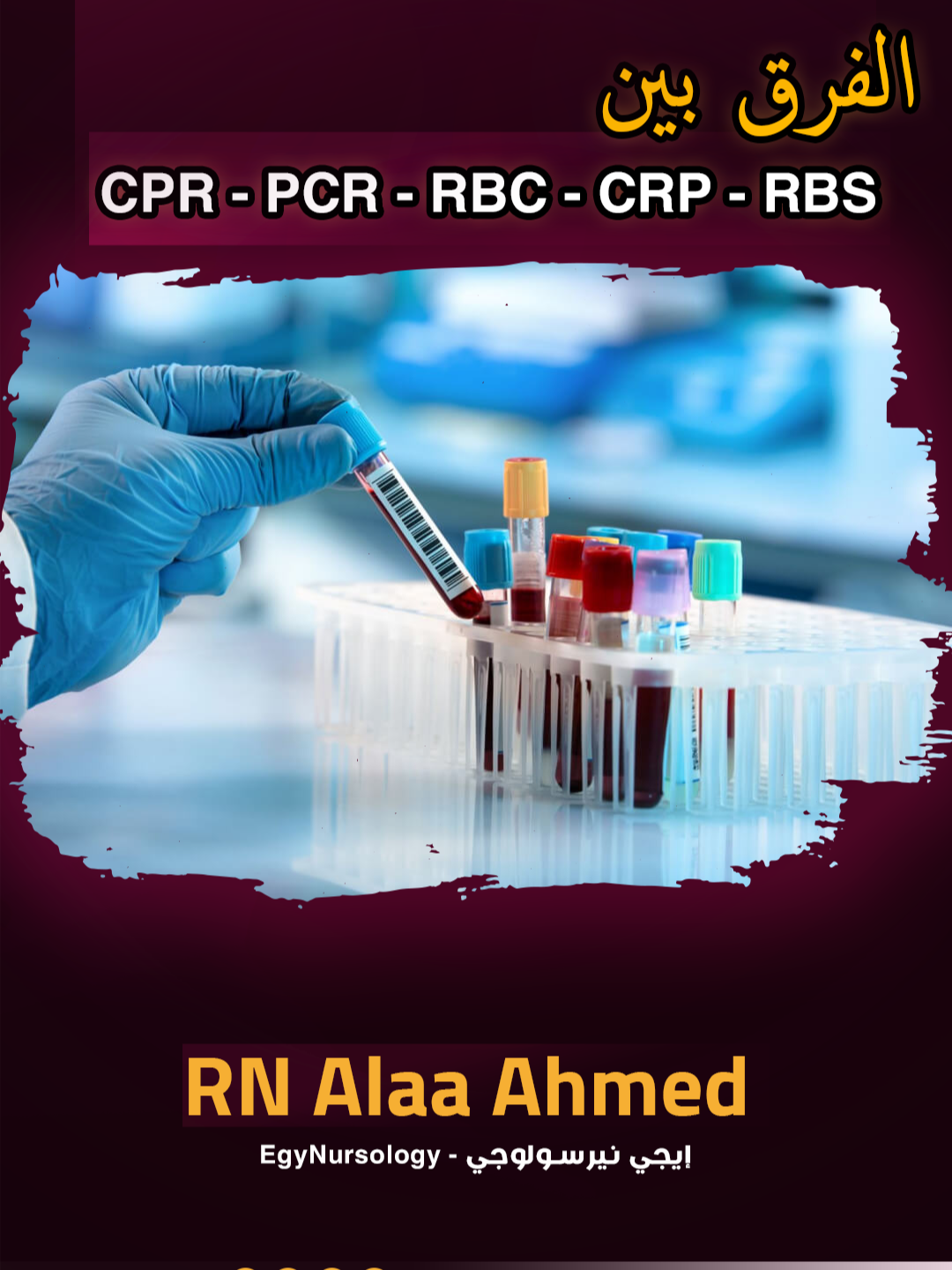 الفرق بين الـ CPR – PCR – RBC – CRP – RBS #crp #crptest #crptestnormalrange #whatiscrp #whatiscrptest #cpr #cprvideo #cprsteps #howtoperformcpr #RBC #RBS