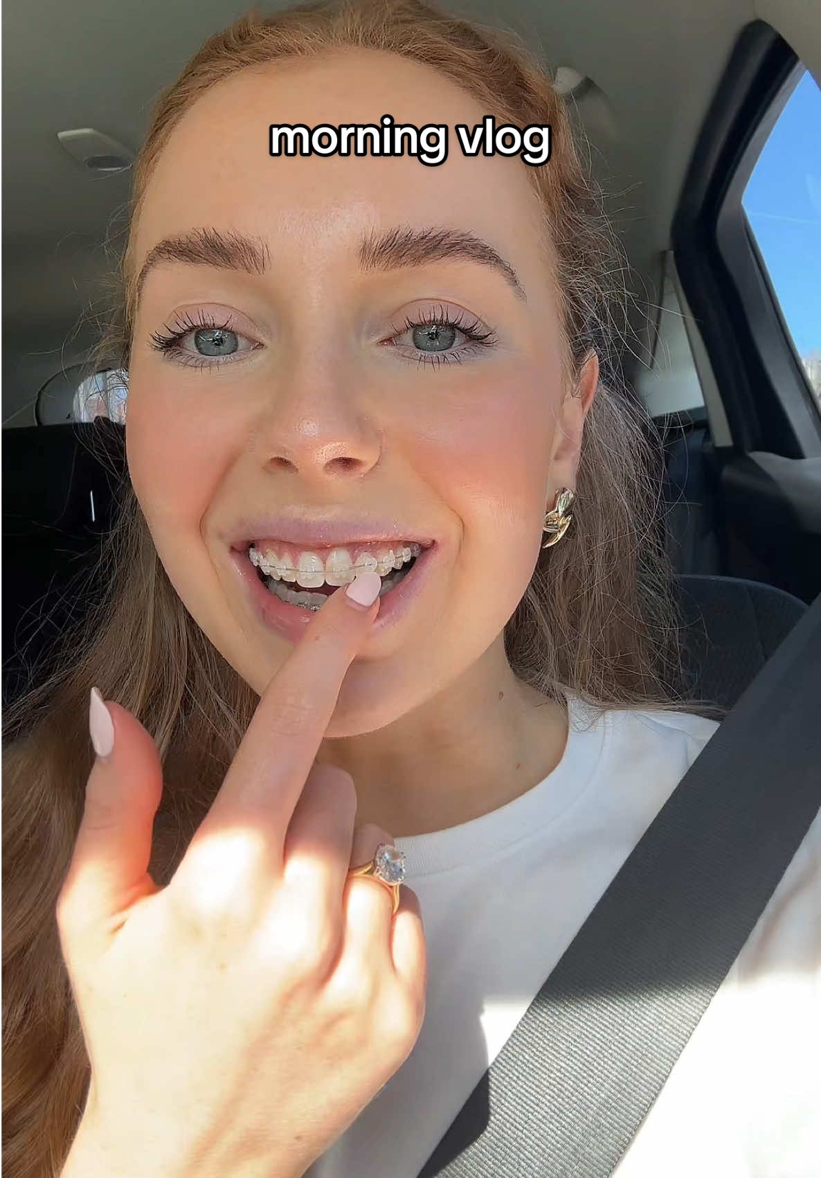 braces update & morning in my life ✨ #Vlog #dayinmylife #Vlogmas #morningroutine #sydney 