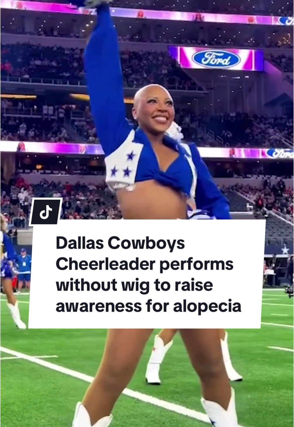 Dallas Cowboys Cheerleader @Armani Latimer has gone viral after she taking to the field this week without her wig to raise awareness for alopecia as part of the #MyCauseMyBoots initiative. “You being different or not having hair … it should never deter you away from reaching for your dreams and your goals.” 💙🤍 #alopecia #alopeciaawareness #dcc #dallascowboys #dallascowboyscheerleaders 
