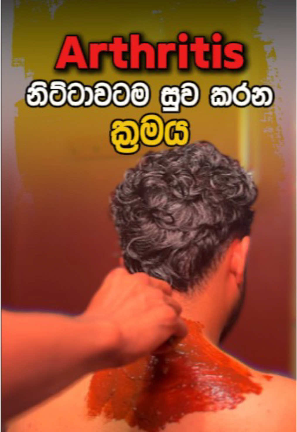 Suffering from arthritis? Would you like to treat it with both internal and external treatments? ඔබත් ආතරයිටිස් නිසා දුක් විදිනවා ද ? අභ්‍යන්තර ප්‍රතිකාර මෙන්ම බාහිර ප්‍රතිකාර හරහා ඔබේ රෝගය සුව කර ගැනීමට ඔබත් කැමති ද ? ඔබත් ඔබේ රෝගී තත්ත්වයන් නිවැරදිව හඳුනා ගනිමින් ඒ සදහා නිවැරදි  හා සාර්ථක දේශීය වෛද්‍ය  ප්‍රතිකාර සහ ඉක්මනින් පහසුවෙන් සකසා ගත හැකි ආයුර්වේද ඖෂධ ලබා ගන්න.අදම Ceylon hospital වෙත පැමිණෙන්න. Call for Your Appointment - 071 250 9898⁩ (+94) Ways to get medical advice: - Visit us at the hospital - Ceylon Hospital Connect  Our trusted hospital that is dedicated to delivering effective treatments by 1000 Doctors.  දක්ෂතම වෛද්‍යවරු 1000ක ගේ සාර්ථක කල ප්‍රතිකාර පමණක් සිදු කරන අපේ විශ්වාසනියම රෝහල. Ceylon Hospital අපේ දේ නිවැරැදිව අපි වෙනුවෙන් ! #ayurvedic🌼🍵🎶 #fyp #kneepain #AyurvedicHospital #horiwila #diabetes #ayurvedahospital #ayurveda #scoliosis #backpain #Hemorrhoids #pcos #PCOD #woundcare #orthopedic #sciatica #asthma #gynecology #fattyliver #beauty #gastritis #ayurvedawellness #varicoseveins #irregularperiods #psoriasis #helawedakama #healthylifestyle #yoga #organic #travelsrilanka #srilankahospital #wellness #arthritis #srilankatourism #migraine #japansrilanka🇯🇵🇱🇰 #italysrilanka🇱🇰🇮🇹 #dubaisrilanka🇦🇪🇱🇰 #kuwaitsrilanka🇱🇰 #srilankatiktok🇱🇰 #qatar_අපි🇱🇰🇶🇦 #lankaninfinland🇫🇮🇱🇰 #uksrilankan #melbournesrilankan #srilankatiktok🇱🇰 #parissrilanka🇱🇰🇫🇷 #srilankakorea🇱🇰🇰🇷 #cyprussrilanka🇨🇾🇱🇰 #travelsrilanka🇱🇰 #ජපන්_හීන🇯🇵❤ 