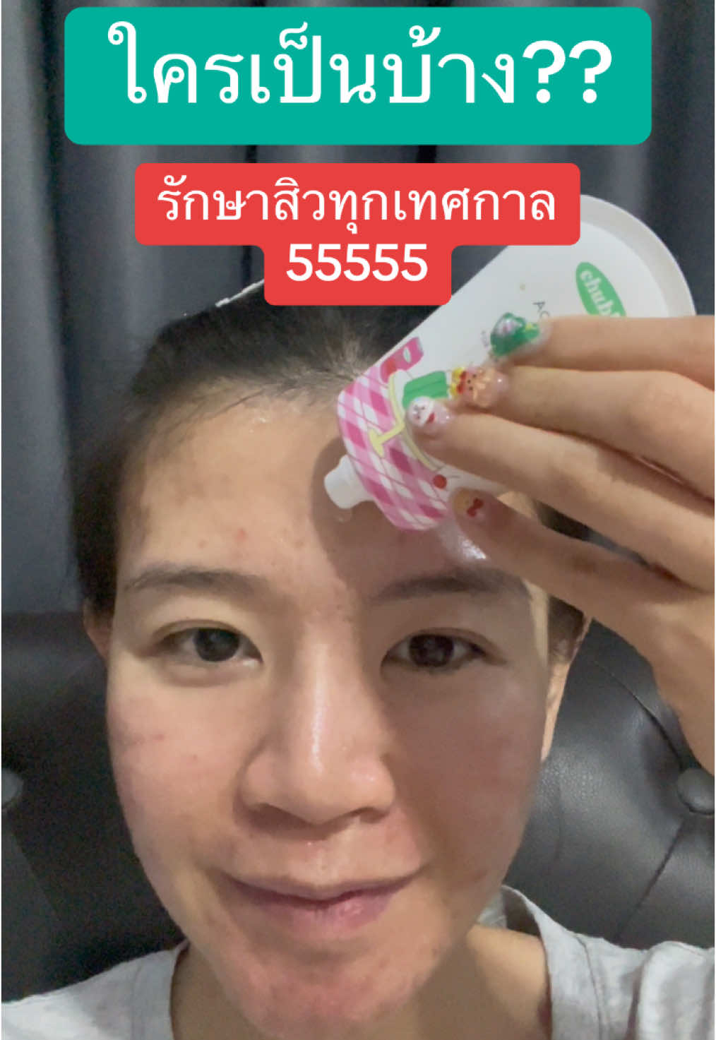 ใช้มาเกือบหมด 1 หลอดแล้ว ชอบอยู่นะ เจลแต้มสิวชับบี้ ใครเป็นสกินแคร์เลย 555 #สิว #รักษาสิว #เจลแต้มสิวชับบี้ #เจลแต้มสิว 