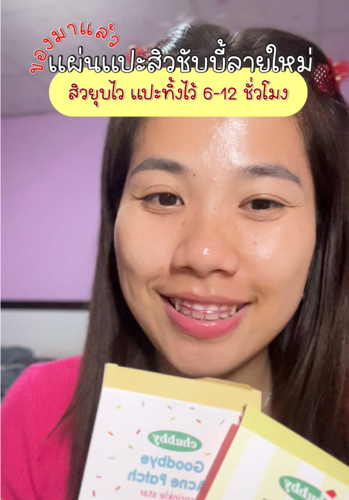 #แผ่นแปะสิวชับบี้ #แผ่นแปะสิว #ชั้บบี้ #Chubby #สู้สิวกับชับบี้#เจลแต้มสิว #เจลแต้มสิวชับบี้