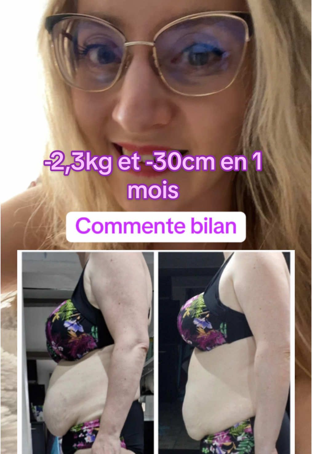 Résultats de Raphaëlla après un mois de cure minceur 1-2-3-4, associée à un rééquilibrage alimentaire : -2,3kg et 30cm de perdu sur tout son corps 😍 Si toi aussi tu veux perdre des kilos, affiner ta silhouette et raffermir ton corps : commente bilan ! #morosil#minceur#mincir#mincirsansregime#maigrir#maigrirensemble#programmeminceur#pertedepoids#perdredupoids#perdredugras#perdreduventre#ventre#ventreplat#kilos#kilosentrop#complexe#phyto#phytotherapie#phytothérapie#complementalimentaire#reequilibragealimentaire#brulegraisse#collagen#collagene#collagendrink#collagenpeptides 