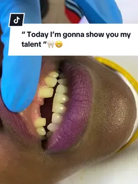 Hurry to New smile dentistry and save your smile😁.  📍50 Smew avenue, Lenesia,1827 Opp Signet Terrence  Call us 072 417 3789