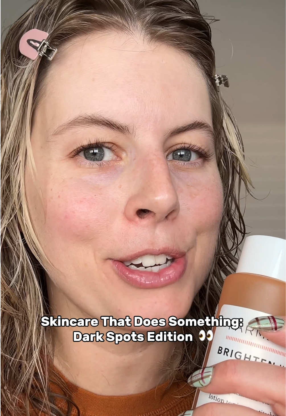 Hyperpgimentation takes time to go away, so make sure to use  this product consitently! And please--for the love of God--wear sunscreen on top  or else your dark spots will come back  @Farmacy Beauty #hyperpigmentation #skincareroutine #darkspots