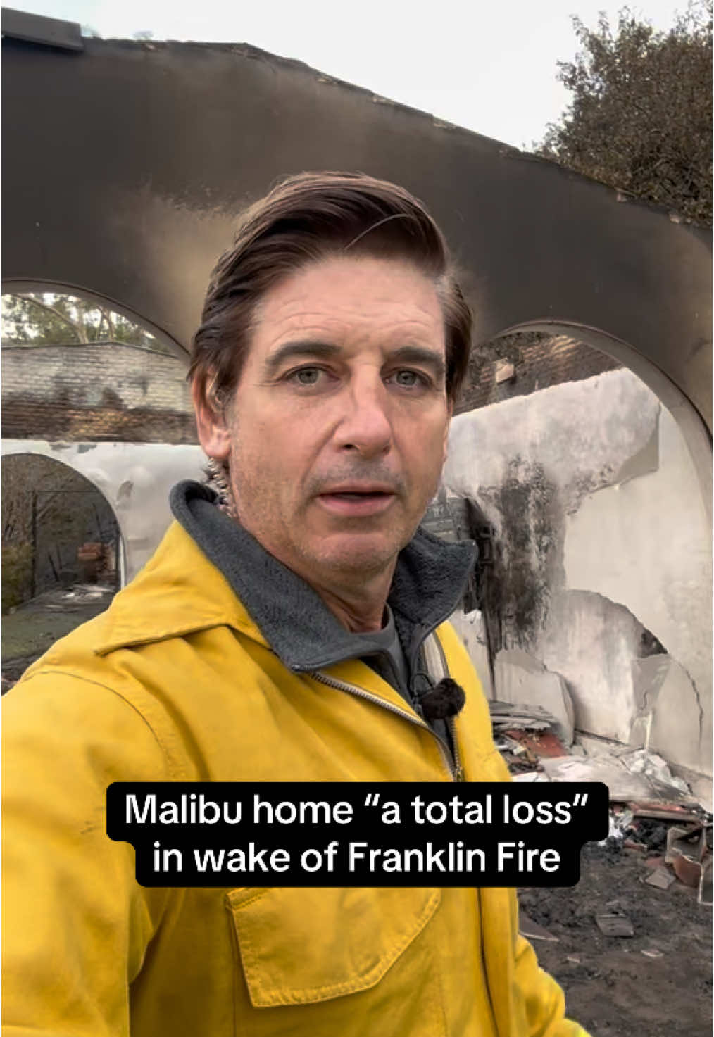 One of the only recognizable aspects of this Malibu home is a TV after the #FranklinFire ripped through, CBS News’ Carter Evans reports, saying the home is now “a total loss.” The fire, which has so far spread to more than 4,000 acres, has completely blackened the hills surrounding the home, leaving the area susceptible to more issues come the rainy season. #malibu #california #fire 