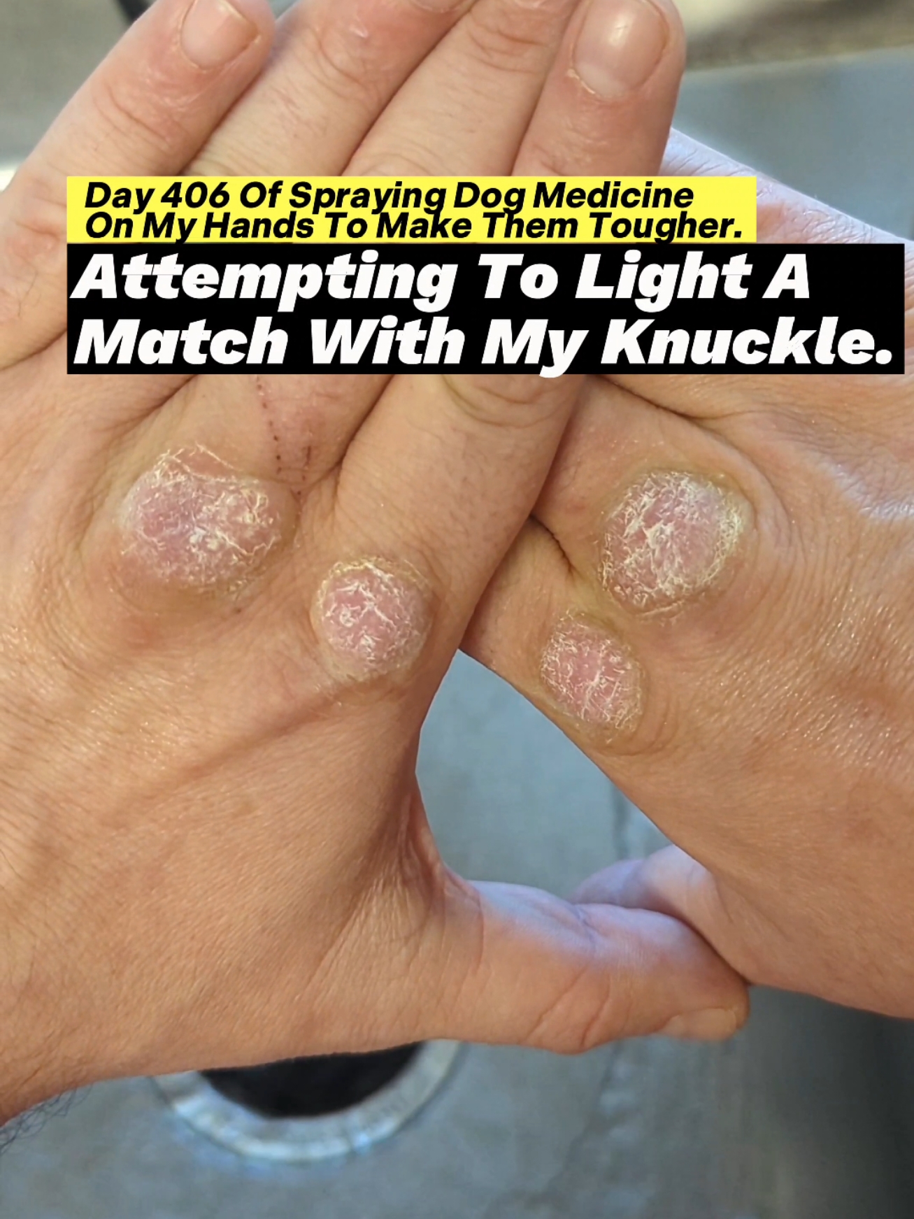 Day 406 Of Spraying Dog Medicine On My Hands To Make Them Tougher. Attempting To Light A Match With My Knuckle. #roughhands #dogmedicine #ironfist #martialarts #sandpaper #boxing #badmintontraining #toughhandspray #dogspray #softhands #bluecollar #asmr #oddlysatisfying #microfibertowel #skincareroutine #guypunchingrocks #fistofthedogmedicine #fyp 