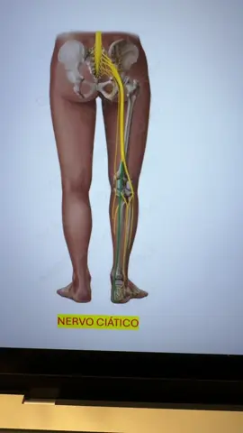 A dor do Nervo Ciatico desce para a região posterior da coxa. A dor do Nervo Femoral desce para a região anterior da coxa. Existem várias causas para a dor no Nervo Ciatico e para a dor no Nervo Femoral. Não é só a Hérnia de Disco que causa essas dores. #nervociatico #nervofemoral #cruralgia #herniadedisco 