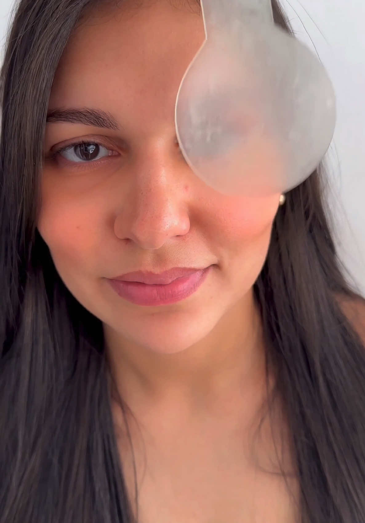 Hoje compartilho a história da Thamara, que sempre usou óculos por conta do estrabismo e da alta hipermetropia. No dia mais especial da sua vida, o casamento, ela realizou o sonho de enxergar perfeitamente e alinhar os olhos com lentes de contato especiais. Momentos assim mostram o poder da optometria em transformar vidas! 💖✨ #estrabismo #optometria #transformandovidas #diaespecial 