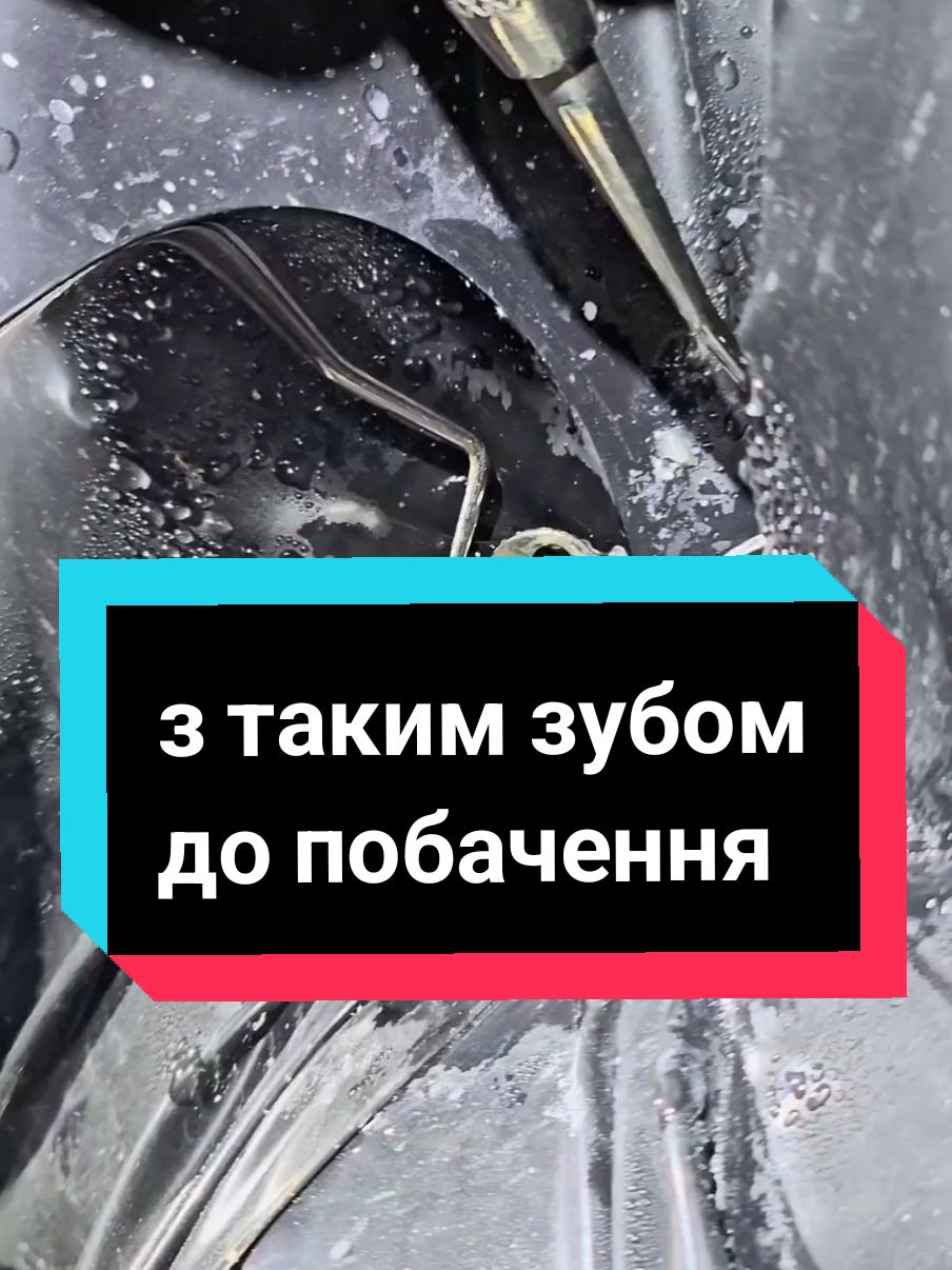 Показую,що відбувається у зубі,коли в ньому є карієс. штифти в зубах,результат.Видалення зубів, імплантація зубів,лікування #вашстоматолог #стоматолог #лікуваннязубів #лікуванняканалів #пломба #карієс #видаленнязубів 