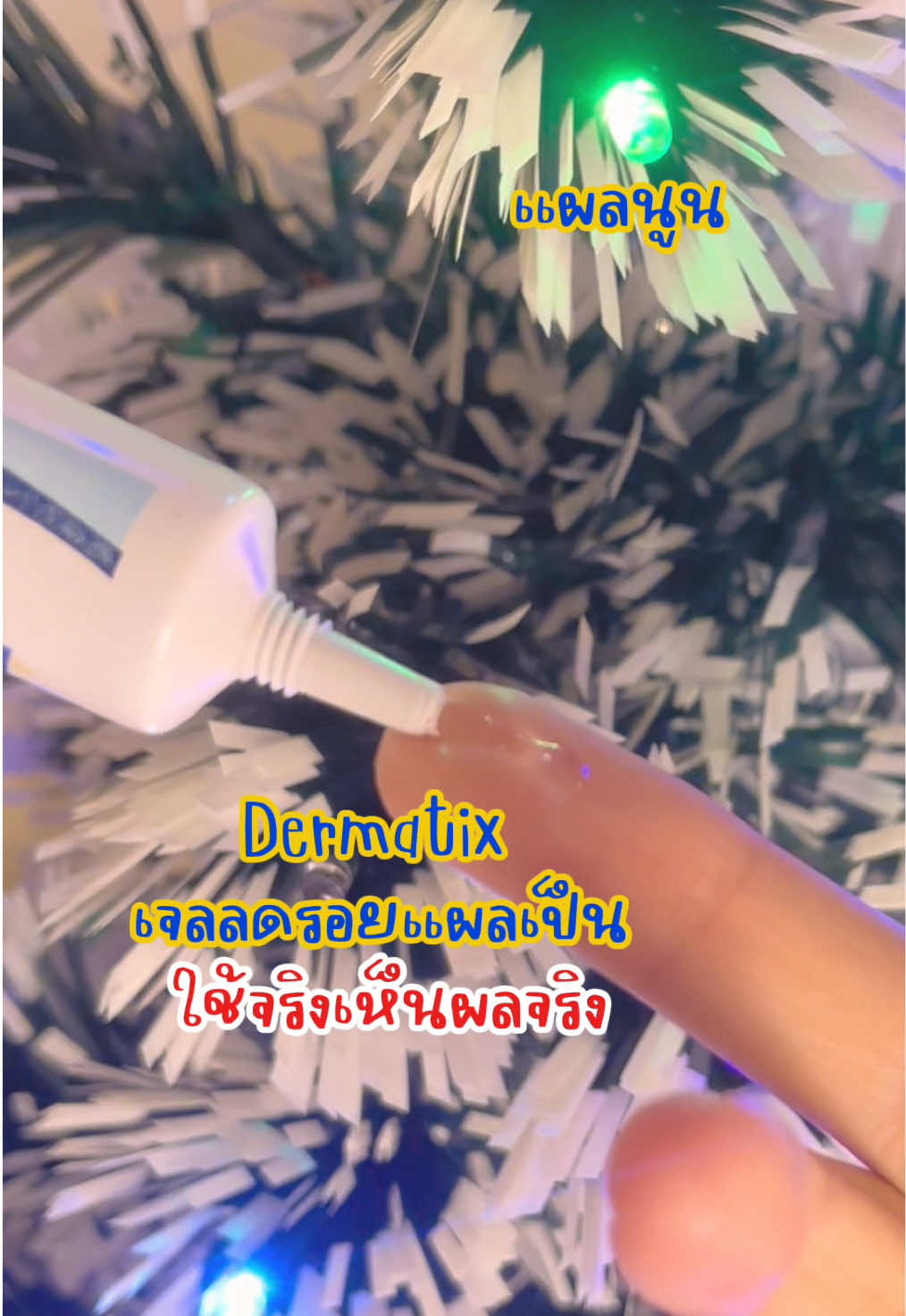 เจลลดรอยแผลเป็น Dermatik ใช้เอง ใช้จริง #รีวิว #รีวิวครีมลดรอยแผลเป็น #Dermatix #ครีมลดรอยแผลเป็น #เจลลดรอยแผลเป็น #ลดรอยแผลเป็น #แผลเป็น #เจลลดรอยแผลเป็น #ลดรอยแผลผ่าตัด #แผลผ่าคลอด #เทรนด์วันนี้ 