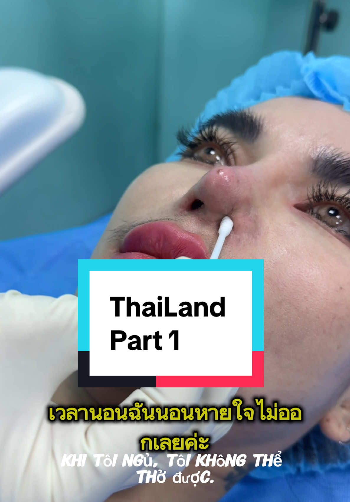 Part 1. Nâng mũi ở thái lan hỏng 5 lần .... #CosmeticSurgery #surgery #rhinoplasty #nose #bsiviet 