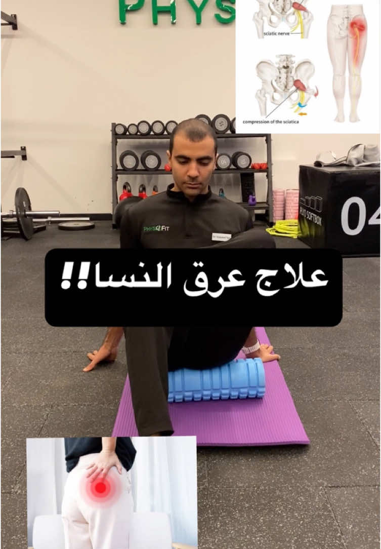 علاج عرق النسا.. #viralditiktok #viral #viral_video #physiotherapy #physio #physiotherapist #rehabilitation #rehabilitacion #rehab #pain #fyp #foru #aclrecovery #aclrehab #lowbackpain 