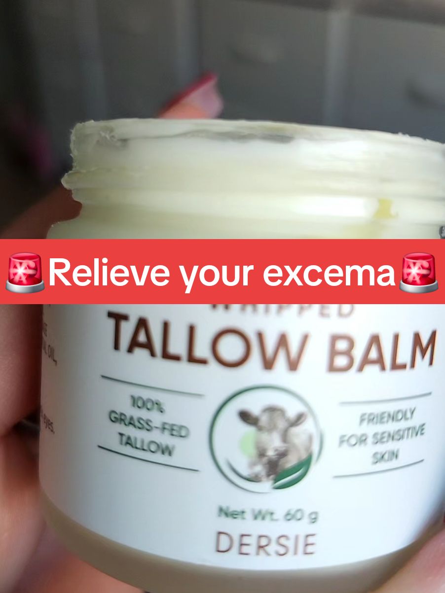 #ConSantanderConecto #excema #excemahelp #tallow #moisturizer #sensitiveskin #fyp #heal #Viral 