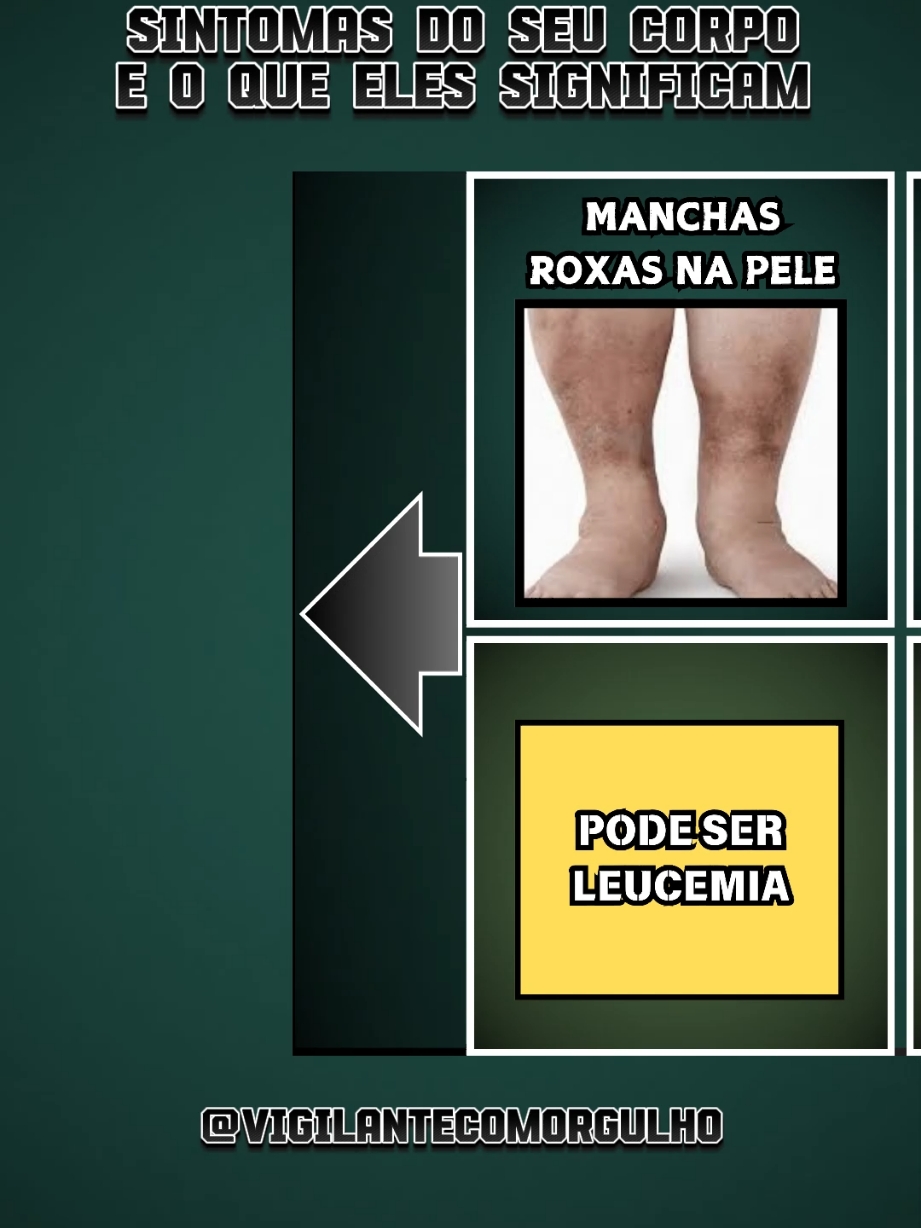 sintomas do seu corpo que indica algo  #doencas #sinaisdoseucorpoqueindicamalgo #doencaseseussintomas #sintomasdedoencas #doencasraras #segurancaprivadadobrasil💀💀💀💀 #controladordeacesso #vigilantespatrimonialdesunido #lojasfamosas #vigia #segurancadeautoridades #segurancaprivada #segurancapublica #novaportariadasegurancaprivada #riodejaneiro❤️ #estatutodasegurancaprivada #vigia 