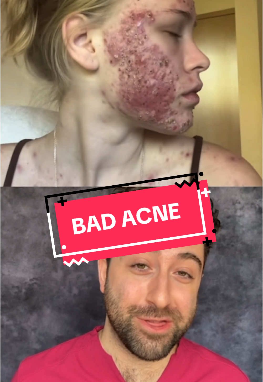 I’m so glad to see this lady has had a response to treatment for her acne - we need to make things more accessible to all ✌️ #acne #dermatologist #treatment #acnetreatment #acnepositivity #acneproblems 