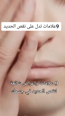 #نقص_حديد حديد