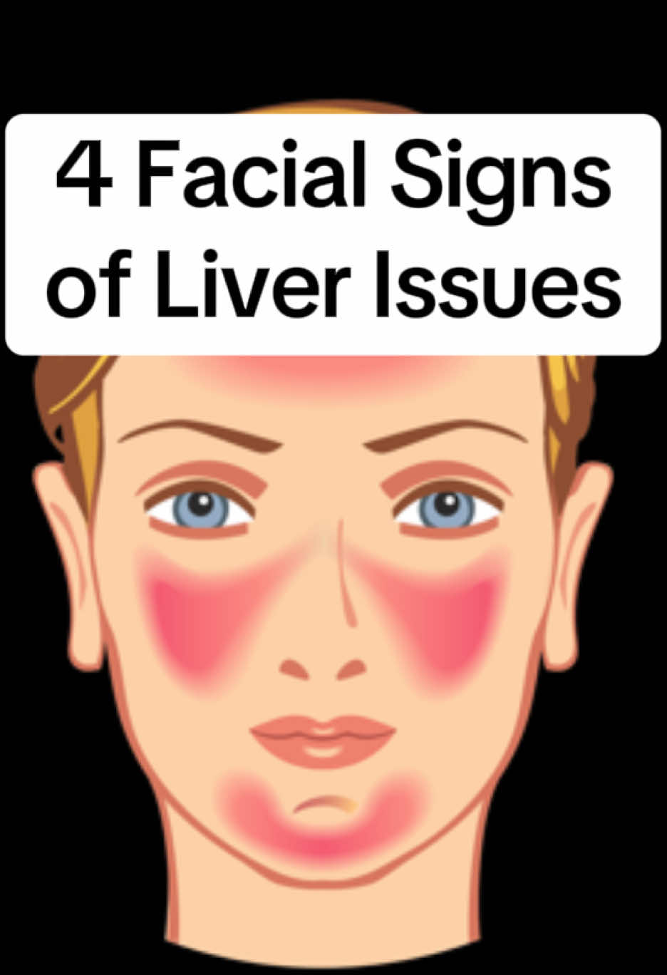 4 Facial Signs of Liver Issues #tiktokhealth #womenshealth #wellness #maha #liverdetox