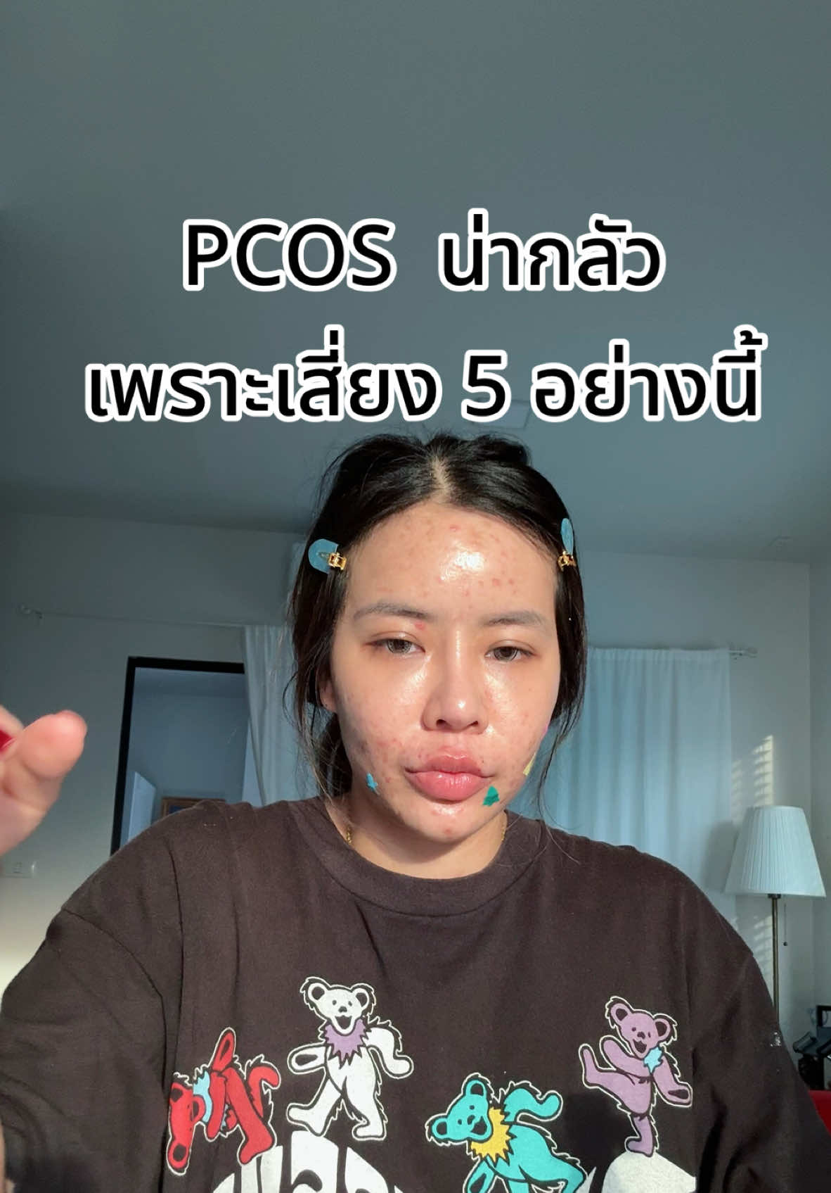 ไหนใครเป็น PCOS เหมือนฟ้าบ้าง #สายฟ้าคนที่เป็นสิวเต็มหน้า #พี่ฟ้าคนที่เป็นสิว #รักษาสิวด้วยตัวเอง #เป็นสิว #สิว #pcos #รักษาpcosด้วยตัวเอง 