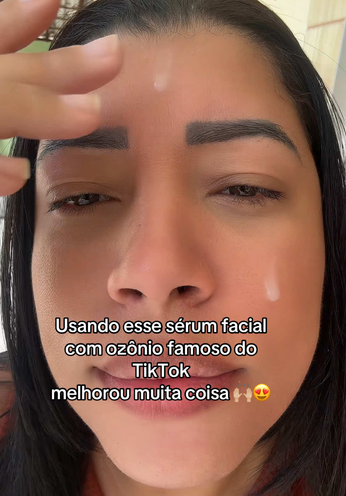 Nem terminei meu tratamento 😱#serum #serumfacial #peleoleosa #rosto #skincare #fouryou #for 