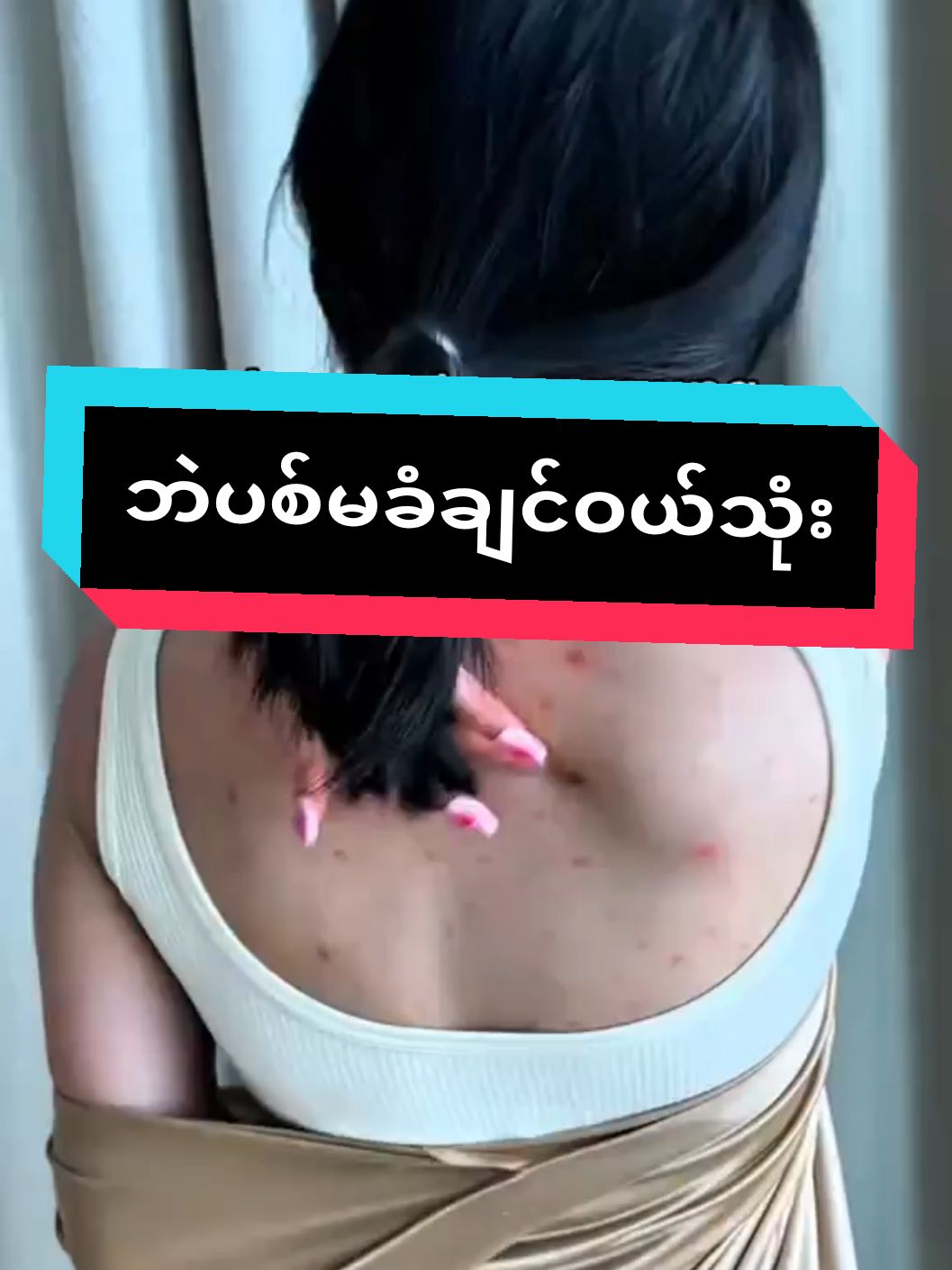 #VoiceEffects #2025မာသူဋ္ဌေးဖစ်ချင်သူလေးတေ #foryoupage #tiktokuni #fyppppppppppppppppppppppp #Qualityကောက်းတာဘဲရောင်းတယ် #အသားမဲဘဝကိုစွန့်လွတ်လိုက်ပါ #မဖြူရင်ငွေပြန်အမ်းမယ်🔥 #kkscrub #thinkdoyoudo #အသားဖြူမြန်ချင်သူများမင်မင်ဆီလာခဲ့ပါနော် #မြင်ပါများပီးချစ်ကျွမ်းဝင်အောင်လို့🤒🖤 #ရှယ်ဖြူရှယ်တန် 