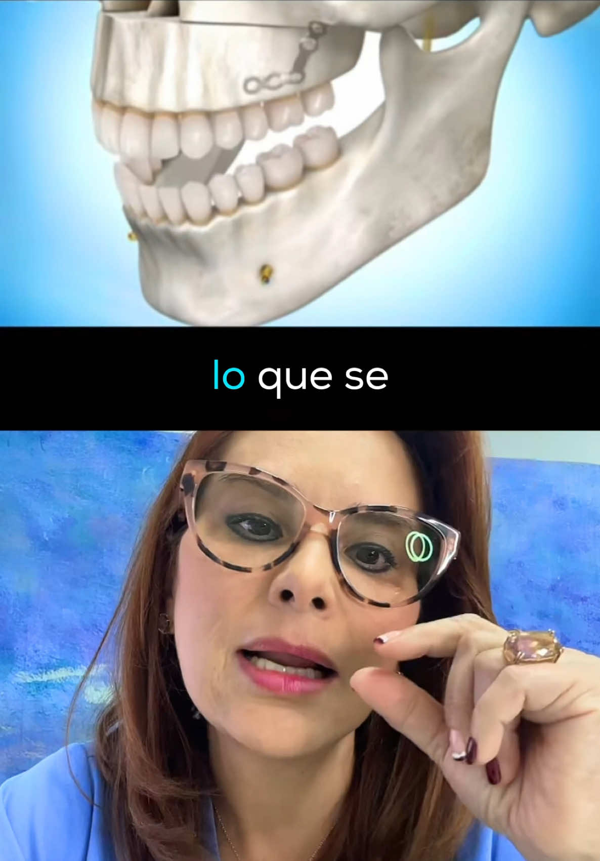 Recuerda: la sonrisa gingival, donde las encías se muestran en exceso al sonreír. 😬 #sinrisagingival #ortognatica #lefort #jawline #jawsurgery #drasandranieto