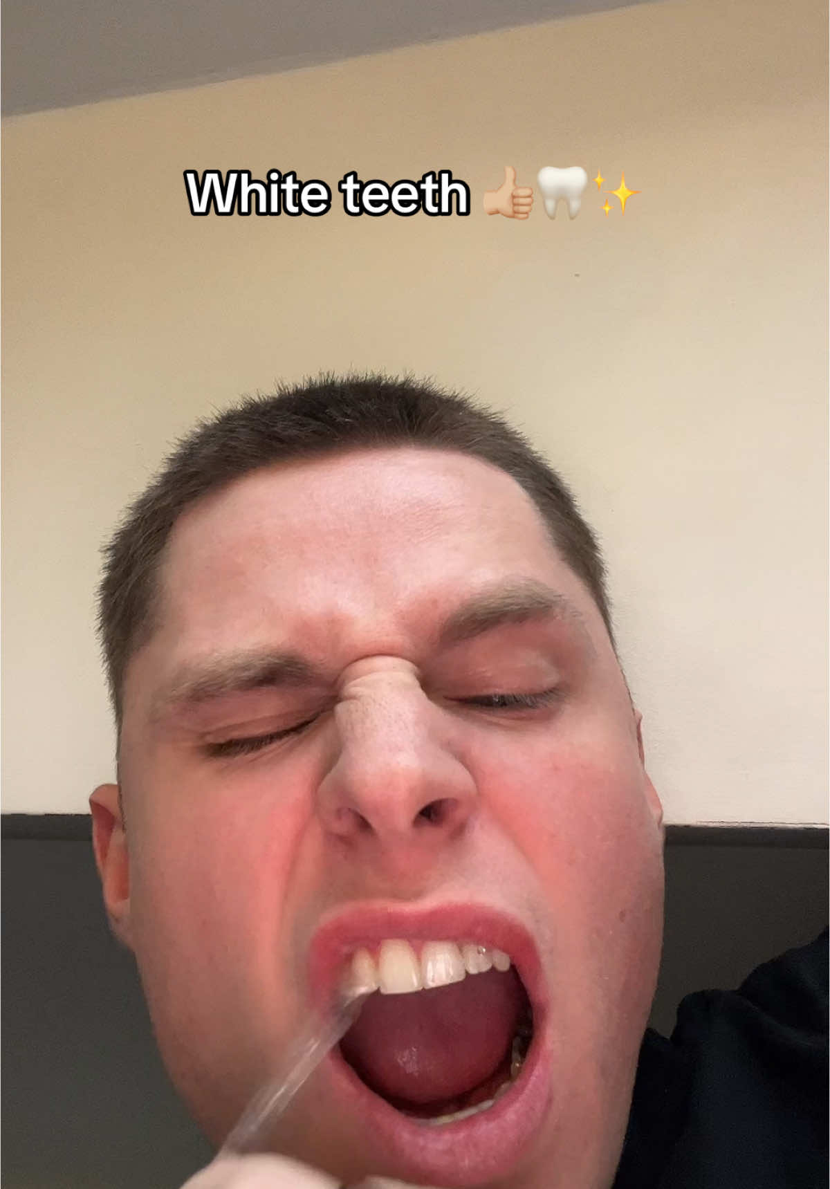 The best strips i’ve used by far! 🦷✨ #teethwhitening #tiktokmademebuyit #polishedlondon 