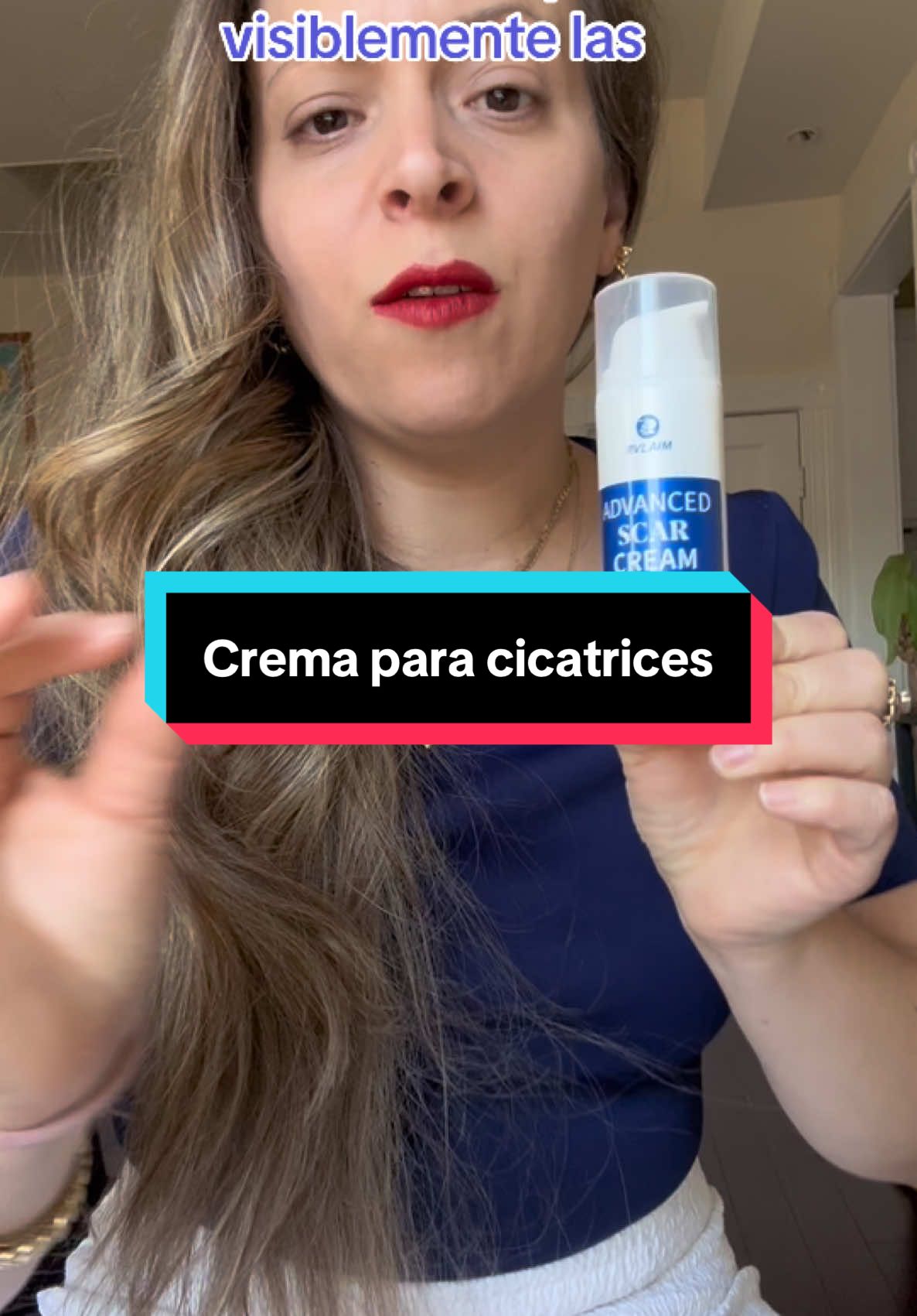 There are several products that can help lighten and improve the texture of scars. This cream will help you visibly lighten scars. Available on tiktokshop. Have you tried any of them yet? This product is my favorite for daily use and excellent for lightening scars. RVlaim Scar Cream Gel, Advanceo Silicone Scar Gel Hydrating Moisturizing Skin 1.7 oz(50ml).                                                    #rvlaim #Rvlaim #scar #cream #gel #advance #silicone #scar #gel #hydrating #hydration #hidratante #hidratantes #cicatricesacne #cicatricesdeacne #cicatricesdeacné #acne #acneskin #acneskincare #acnetips #tip #tiptok #tiptiktok #quemaduras #quemadura #visible #mejorar #cuerpo #cuerposano #cuerpoperfecto #cuerpohumano #absorber #avanzada #cirujias #cirujiasplasticas #CuidadoDeLaPiel #RutinaDeBelleza #cicaplast #skincareroutine #cremahidratante #skincare #skincareroutine #skincaretips #skins #skin #tiktokshopfinds #tiktokshopholidaydeals #tiktokshopholidayhaul #tiktokshopcybermonday #tiktokshopblackfriday #tt #ttshop #ttsacl #tiktoksho #TikTokShop #tiktokpartner #tiktoker #happy #happyathome #christmas #navidad #navidadentiktok #gift #giftideas #everyday #momstyle #mujer #mujeres #mujeresqueinspiran #mujerempoderada #mujereslatinas #mujeresfuertes #mujeresalpoder #mujereshermosas #gift #giftideas #navidad #navidadentiktok #christmas #regalos #regalo #regaloscreativos #regalosorpresa #regalosdenavidad #recommendations #recomendation #recomendado #recomendados #recomendada #tiktokshopfinds #mom #momtok #MomsofTikTok #moms #mamadedos #mamatiktok #momsoftiktok #momlife #mom #moms #mommy #t #tt #ttsacl #ttshop #tiktokshop 