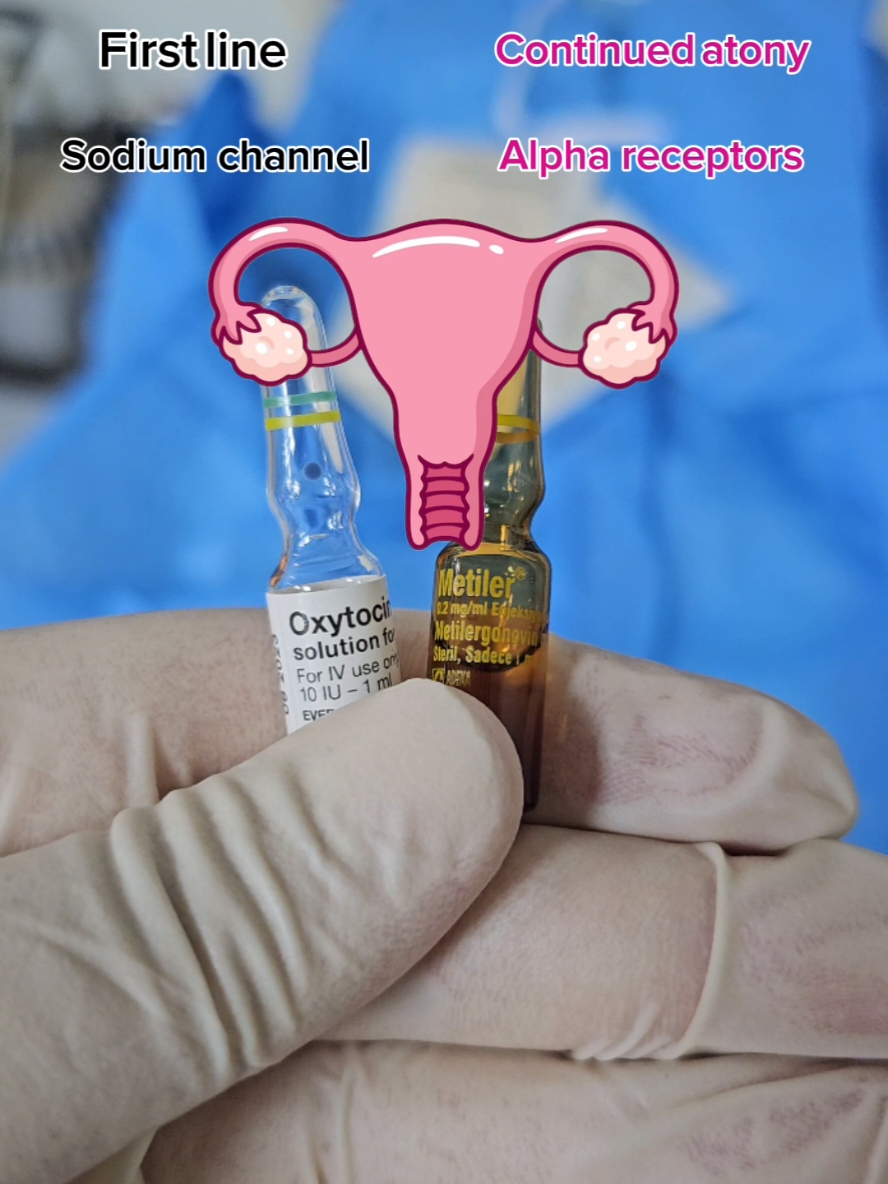 Oxytocin vs Methergine  #تخدير  #تخديروانعاش  #anesthesialife  #anesthesiologist  #viral  #viralvideos 