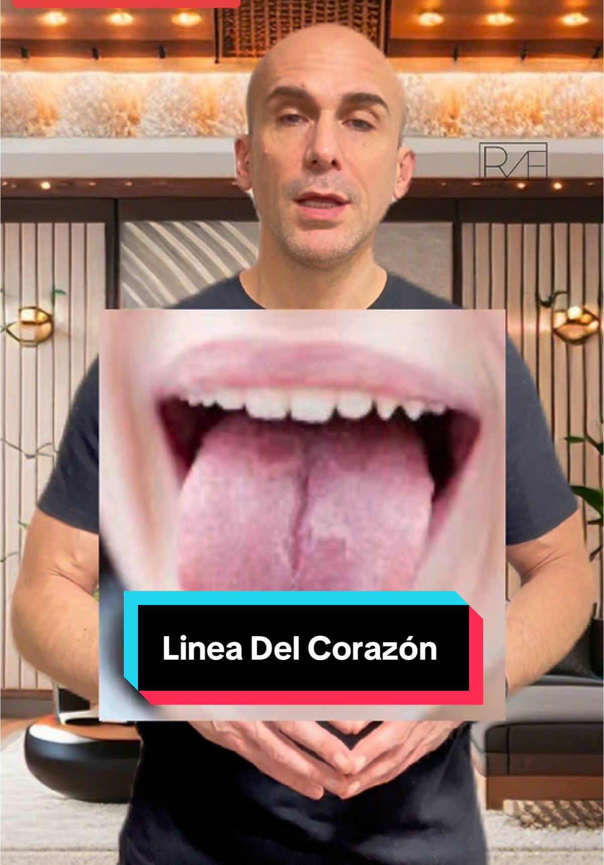 Herida enocional en la lengua!!  Tienes esta linea marcado en la lengua?  #Lengua #amor #emocional #desequilibrio #acupuntura #medicinanatural #medicinachina #bienestar #salud #acupresion #tratamiento #recuperacion #recuperacionfuncional #doloremocional